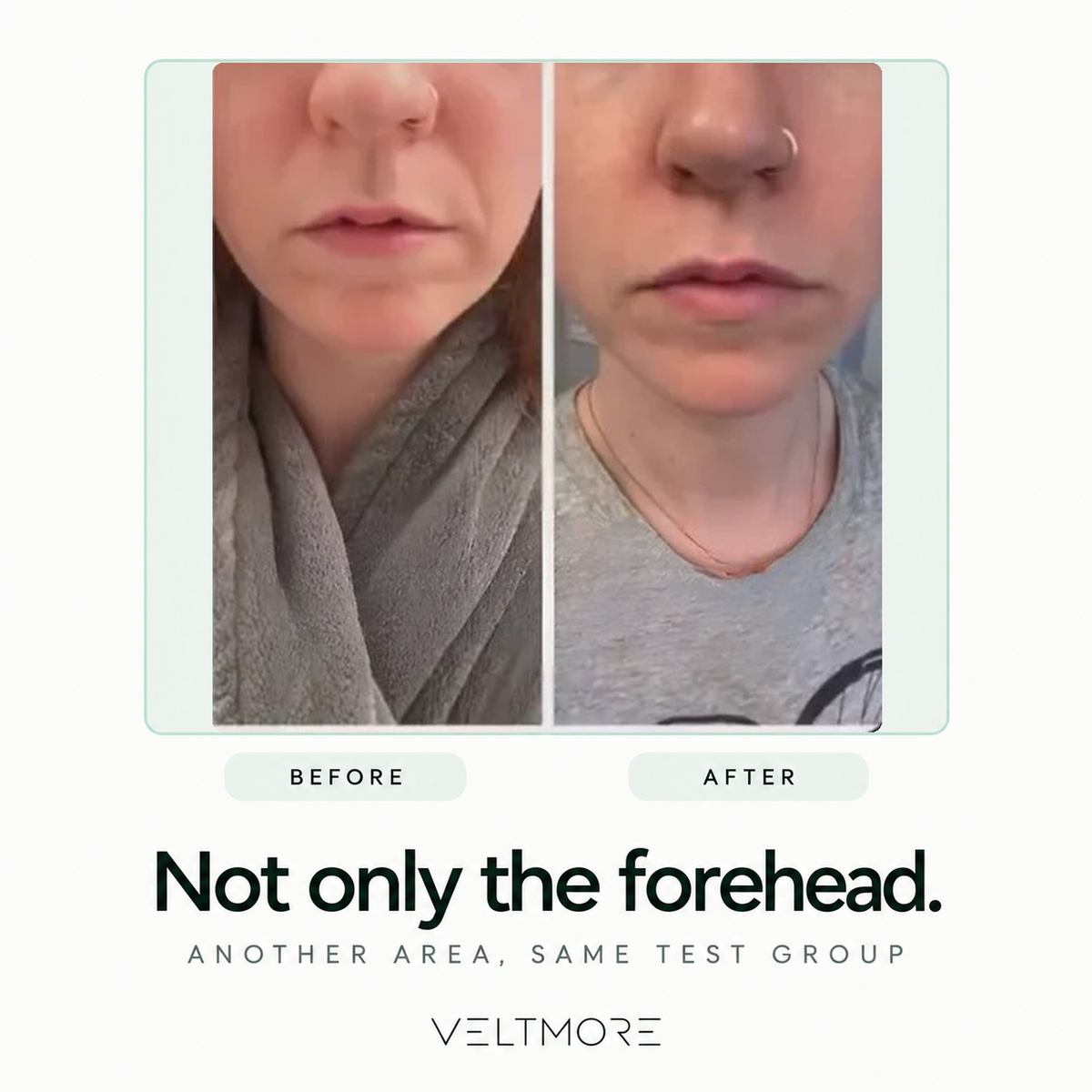 Not only the forehead - another area, same test group